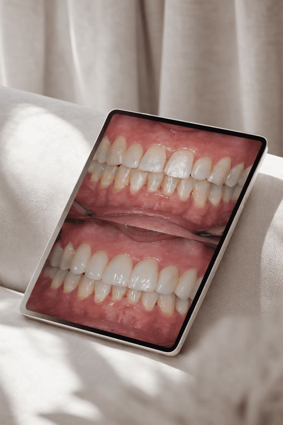 Contenido de estética dental diseñado por Blum Studio
